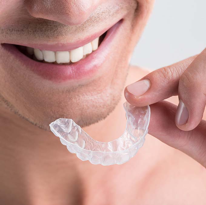 invisalign